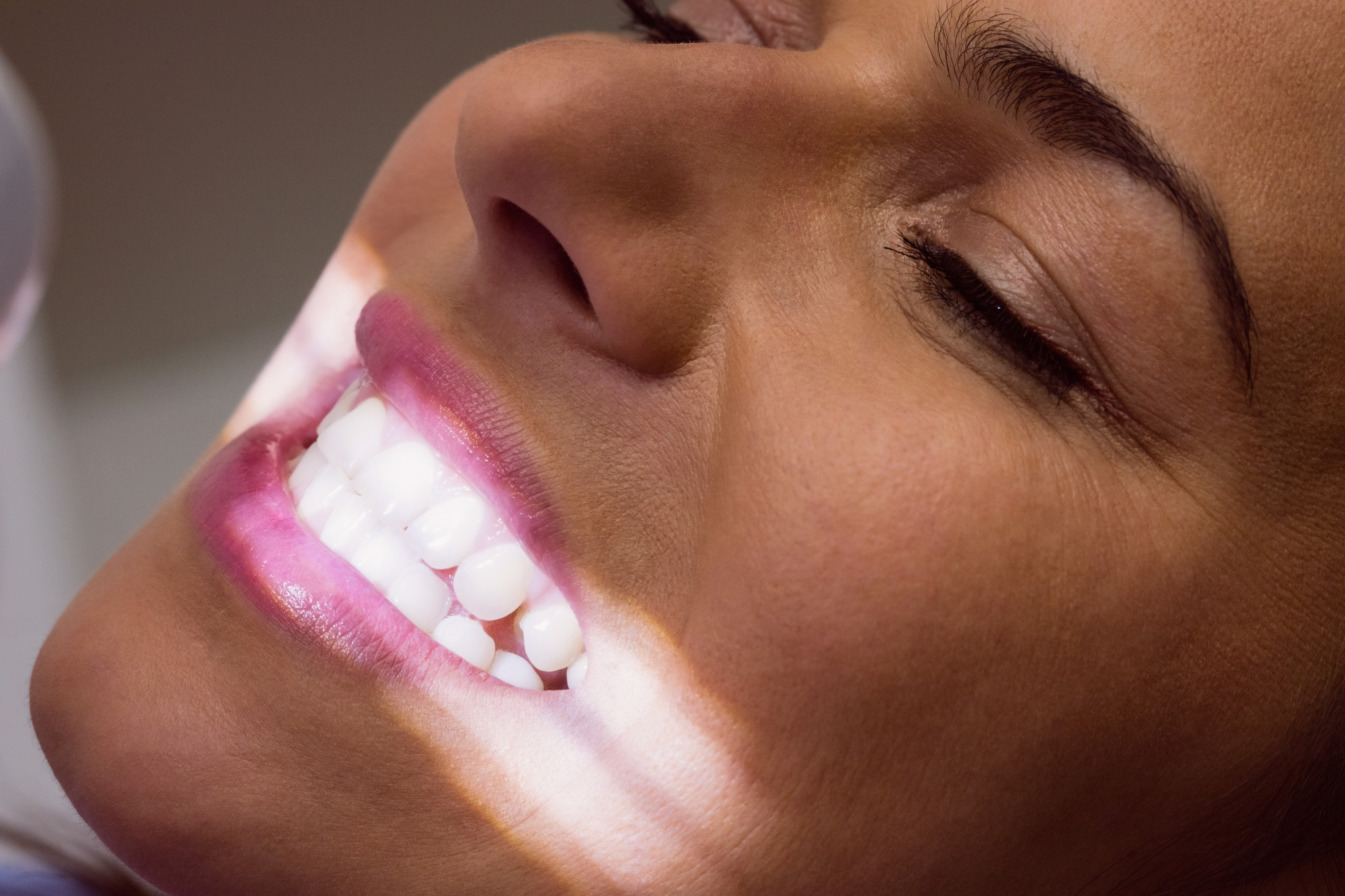 Blanqueamiento dental en El Vendrell
